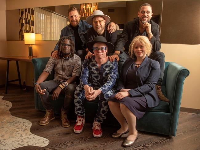 With albinism, musician Lazarus finds light in the darkness | iNFOnews.ca With albinism, musician Lazarus finds light in the darkness | iNFOnews.ca