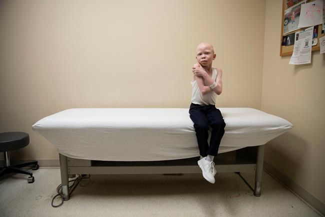 New limbs for growing bodies: Mutilated albinos get refitted | iNFOnews.ca New limbs for growing bodies: Mutilated albinos get refitted | iNFOnews.ca