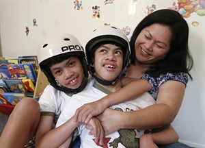 Decade after conjoined twins separated, 1 boy dances to music and the other struggles to walk | iNFOnews.ca CP29366292