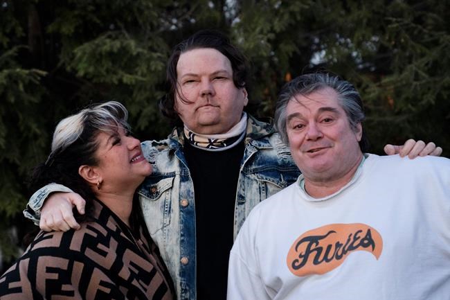 'New chance at life': Man gets face, hands in rare surgery | iNFOnews.ca 'New chance at life': Man gets face, hands in rare surgery | iNFOnews.ca