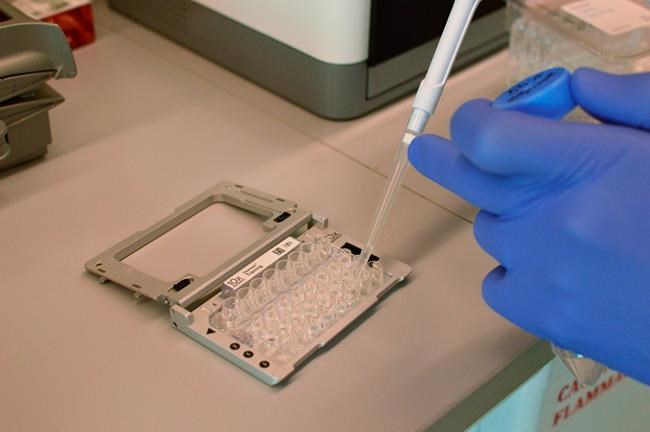 New techniques let scientists zero in on individual cells | iNFOnews.ca