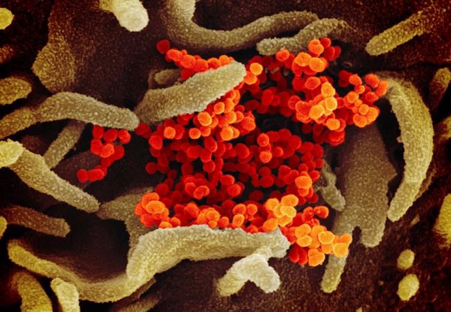 Questions complicate efforts to contain new virus from China | iNFOnews.ca