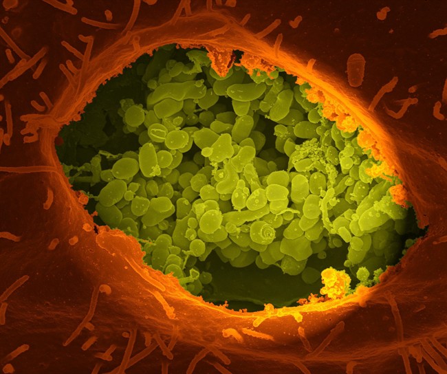 Rare Q fever outbreak reported in American medical tourists who got sheep cell injections | iNFOnews.ca CP34775697