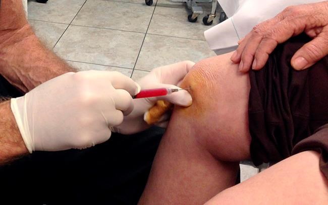 US health agency to crack down on risky stem cell offerings | iNFOnews.ca