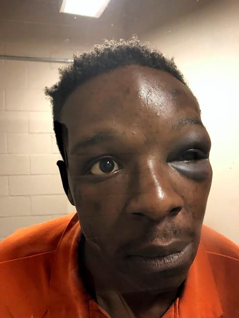 Sheriff: Deputy on video punching Black man in Georgia fired | iNFOnews.ca