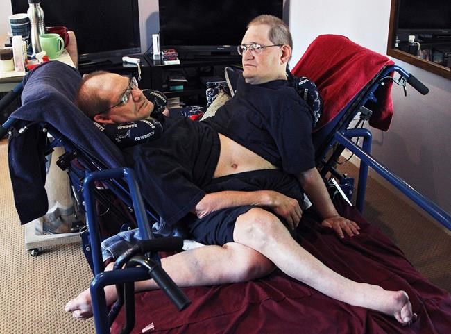 World's longest-surviving conjoined twin brothers die at 68 | iNFOnews.ca