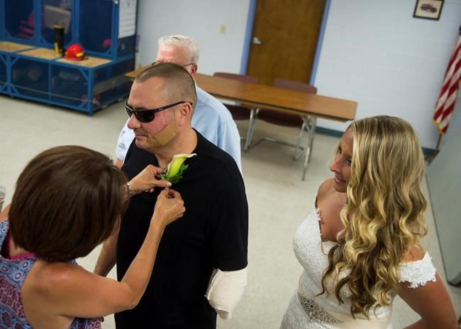 Police chief who lost arm to fireworks married 18 days later | iNFOnews.ca