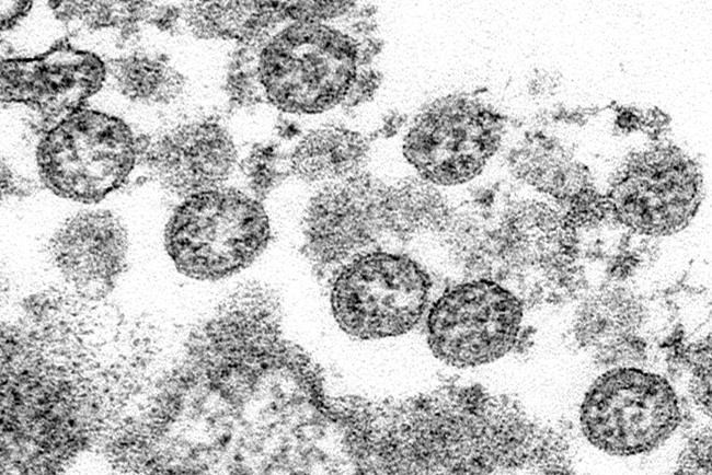 The latest numbers on COVID-19 in Canada for Sept. 6 | iNFOnews.ca The latest numbers on COVID-19 in Canada for Sept. 6 | iNFOnews.ca