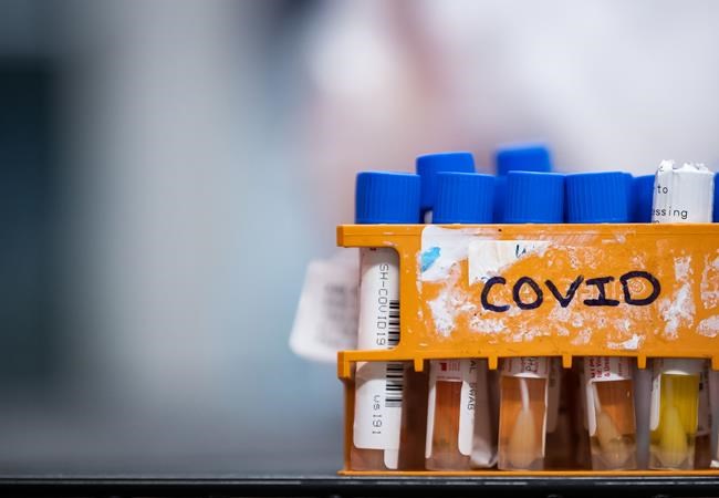 Region of Peel 'accidentally' mails wrong COVID-19 test results to 16 people | iNFOnews.ca Region of Peel 'accidentally' mails wrong COVID-19 test results to 16 people | iNFOnews.ca