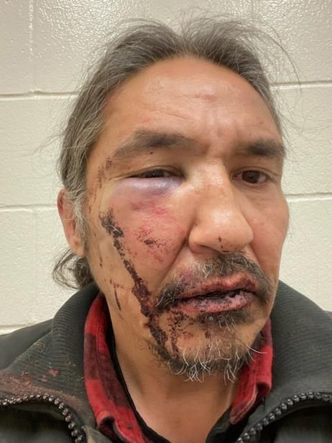 'A true victory:' Charges dropped against Alberta chief in violent arrest | iNFOnews.ca