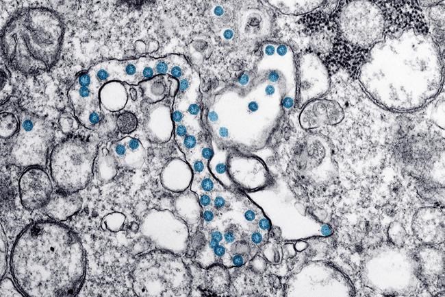 Minds behind pandemic predicting algorithm already thinking about future beyond COVID-19 | iNFOnews.ca CP917716500