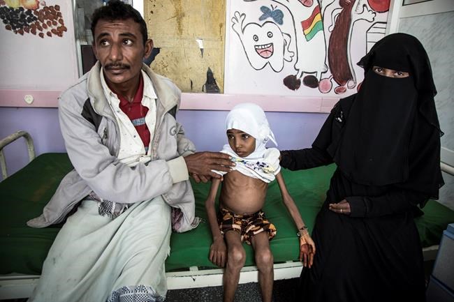 UN says civilian casualties in Yemen average 123 per week | iNFOnews.ca