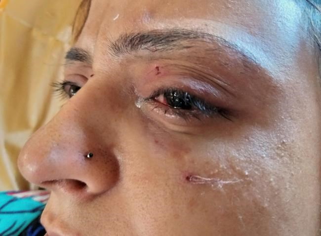 No phone calls, no groceries: Kashmir on edge under lockdown | iNFOnews.ca