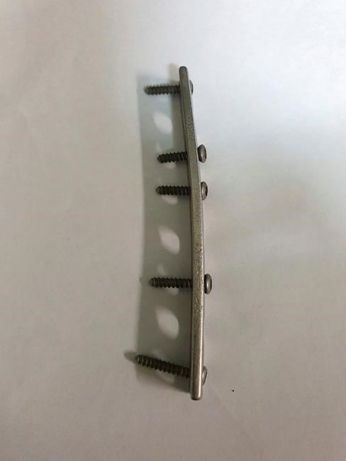 Australian farmer says human orthopedic plate found in croc | iNFOnews.ca