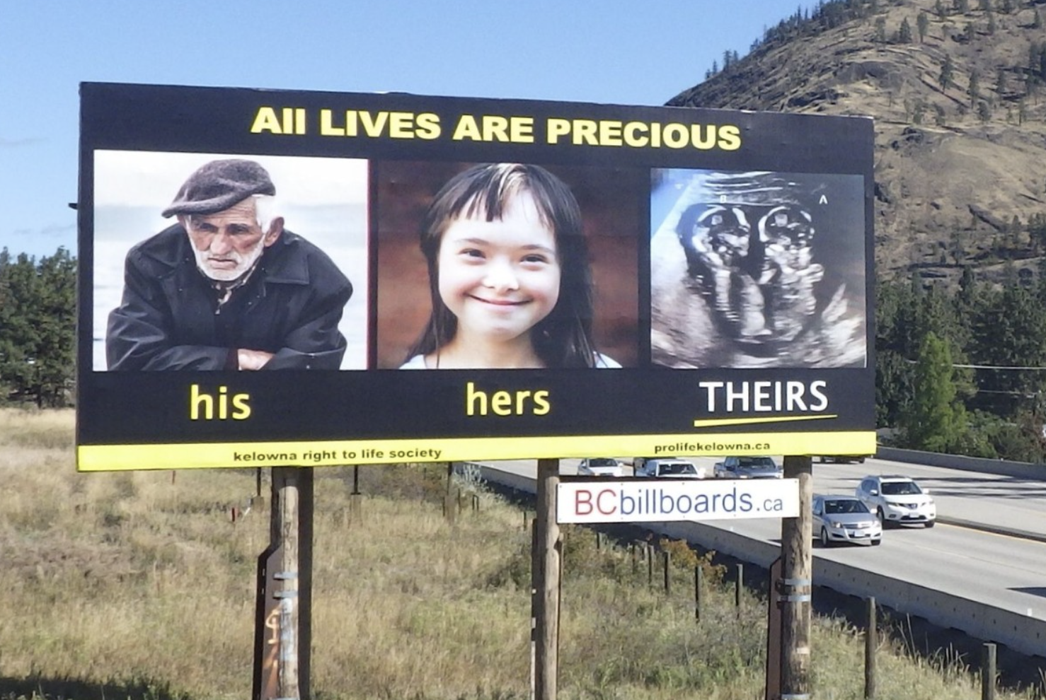 A billboard with an old man, a girl with Down's syndrome and twin fetuses.