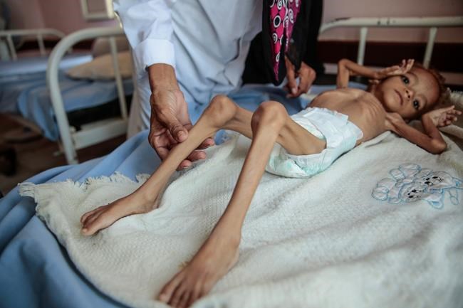US terror designation for Yemen rebels raises famine fears | iNFOnews.ca US terror designation for Yemen rebels raises famine fears | iNFOnews.ca