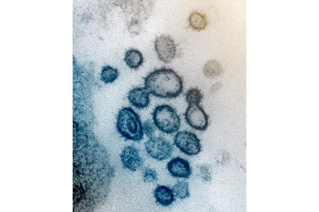 PNG demands China explain COVID-19 vaccine trial on miners | iNFOnews.ca