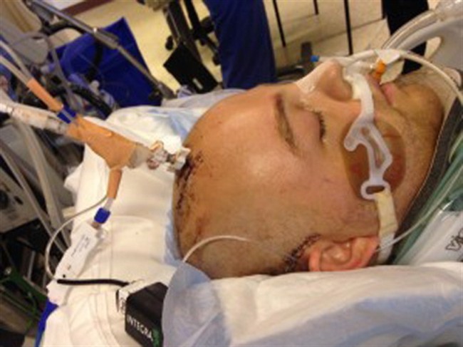 Booze and bravado fuelling one-punch attacks that change lives: Vancouver police | iNFOnews.ca CP35472799