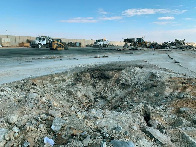 Brain injuries in Iraq put attention on invisible war wounds | iNFOnews.ca