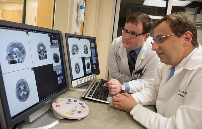 Brain scans find protein a marker of Alzheimer's decline | iNFOnews.ca Brain scans find protein a marker of Alzheimer's decline | iNFOnews.ca