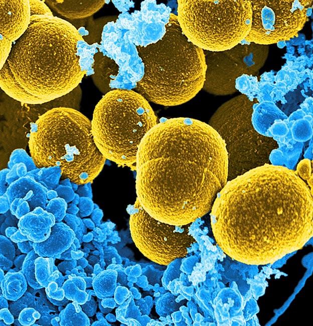 Adding friendly bacteria to skin lotion wards off bad germs | iNFOnews.ca