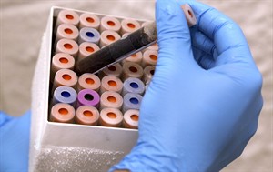 Virus or bacteria? Experimental test aims to help docs tell, reducing unneeded antibiotic use | iNFOnews.ca CP25045275