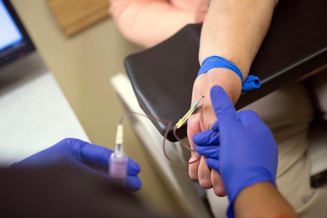 Worth it? A faster transplant but a kidney with hepatitis C | iNFOnews.ca