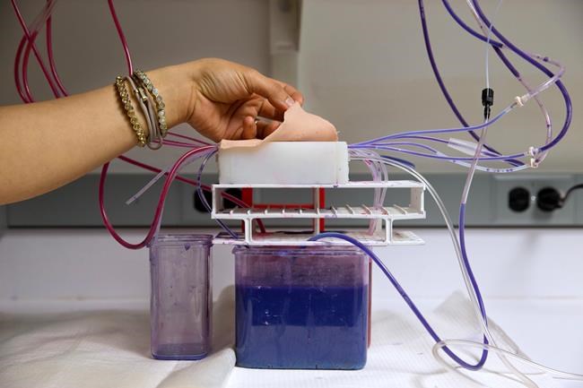 Studies shine light on mysterious placenta, how it goes awry | iNFOnews.ca Studies shine light on mysterious placenta, how it goes awry | iNFOnews.ca