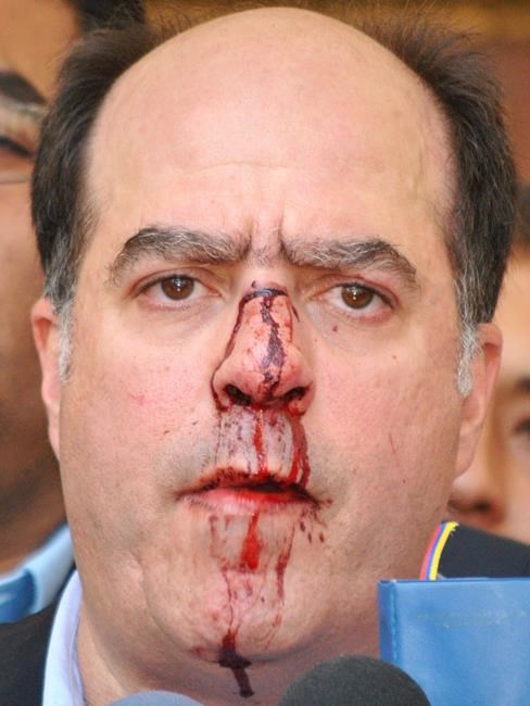 Venezuela opposition leader hit with a pipe in the face | iNFOnews.ca Venezuela opposition leader hit with a pipe in the face | iNFOnews.ca