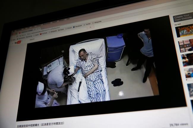 China invites foreign experts to treat Nobel laureate Liu | iNFOnews.ca