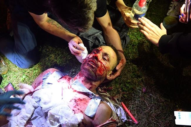 Protester dies in clashes after disputed Belarus vote | iNFOnews.ca