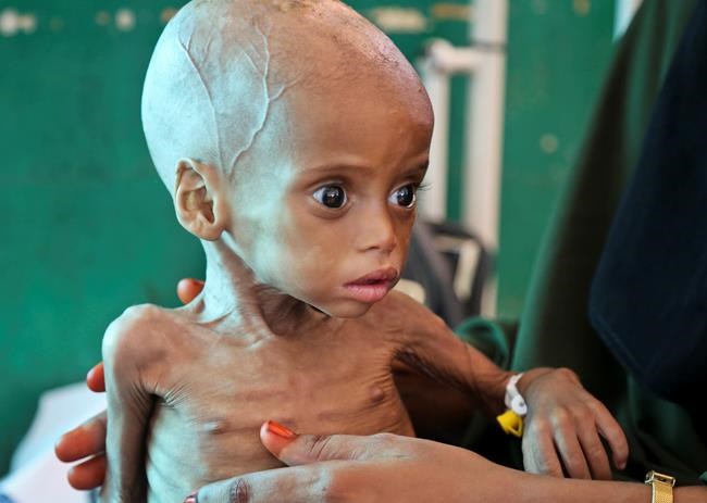 Africa's inequality stifles growth, says report | iNFOnews.ca Africa's inequality stifles growth, says report | iNFOnews.ca