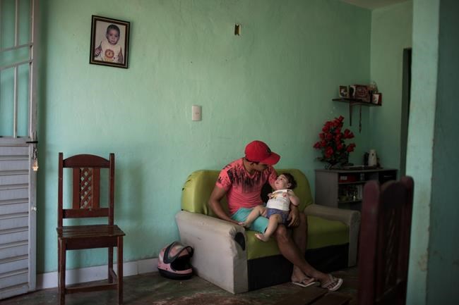 Zika 'syndrome': Health problems mount as babies turn 1 | iNFOnews.ca