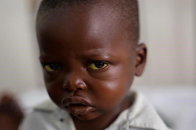 Yellow fever vaccination drive starts; global spread warned | iNFOnews.ca Yellow fever vaccination drive starts; global spread warned | iNFOnews.ca