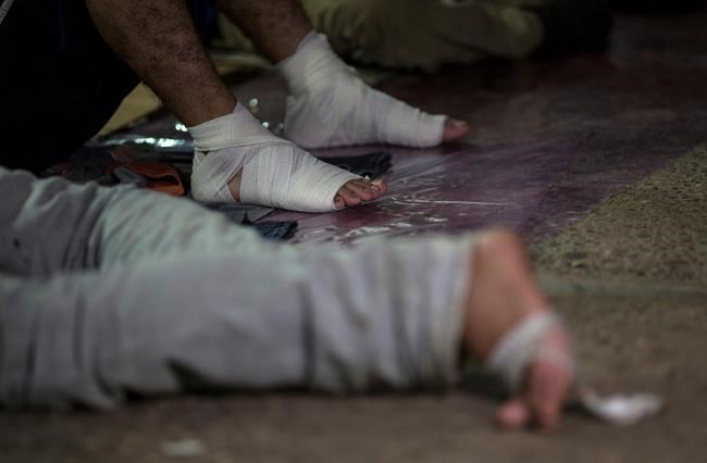 Swollen and blistered feet are big challenge for migrants | iNFOnews.ca