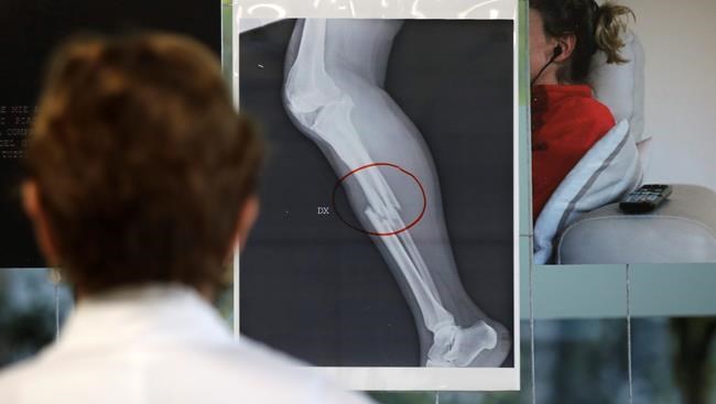 Milan hospital displays X-rays of women attacked by men | iNFOnews.ca CP385201224