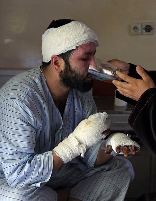 Forever scarred, survivors of IS Kabul attacks struggle on | iNFOnews.ca