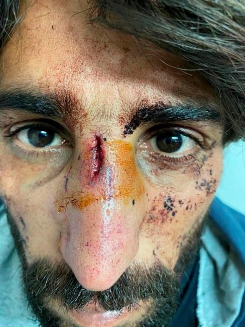 Croatia accused of brutality, sexual abuse against migrants | iNFOnews.ca