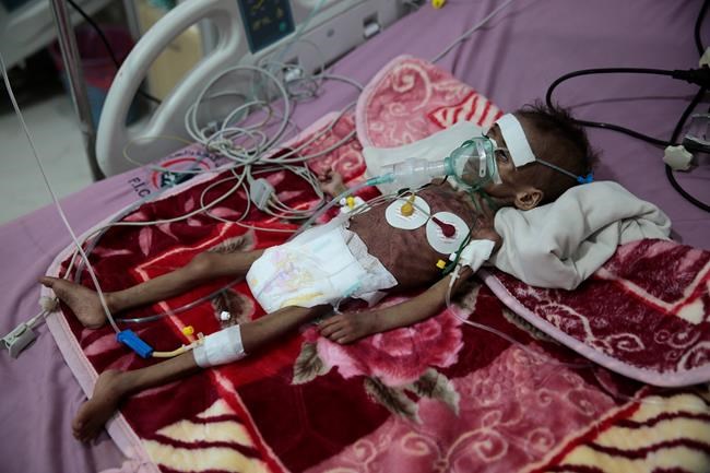 UN agencies warn window to prevent famine in Yemen narrowing | iNFOnews.ca