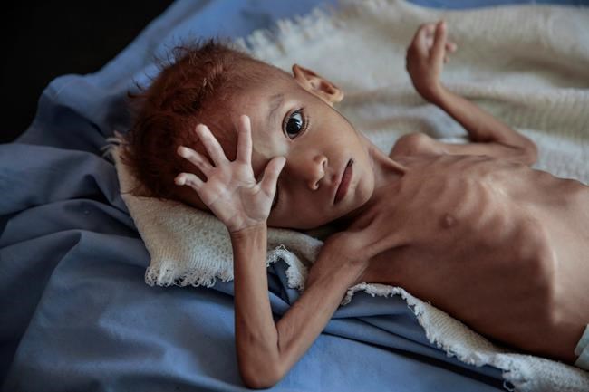 Yemen's Houthi rebels impeding UN aid flow, demand a cut | iNFOnews.ca