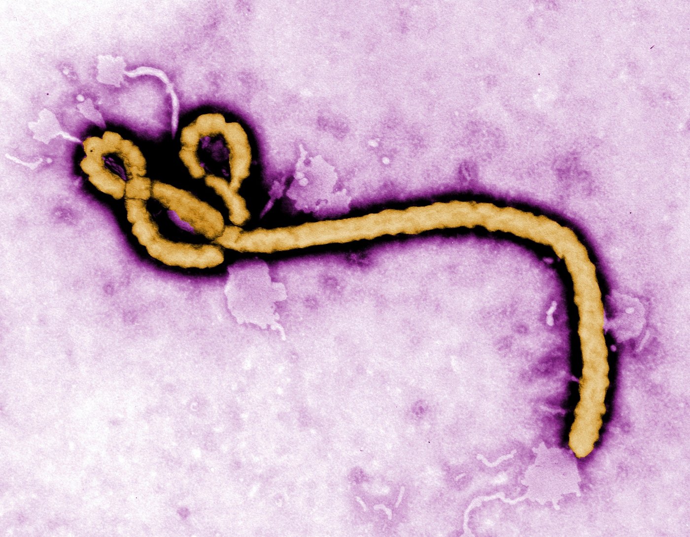 A look at major Ebola outbreaks and when the disease was first identified | iNFOnews.ca