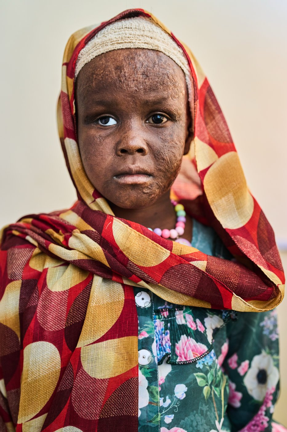 The scars of war among survivors in Sudan | iNFOnews.ca