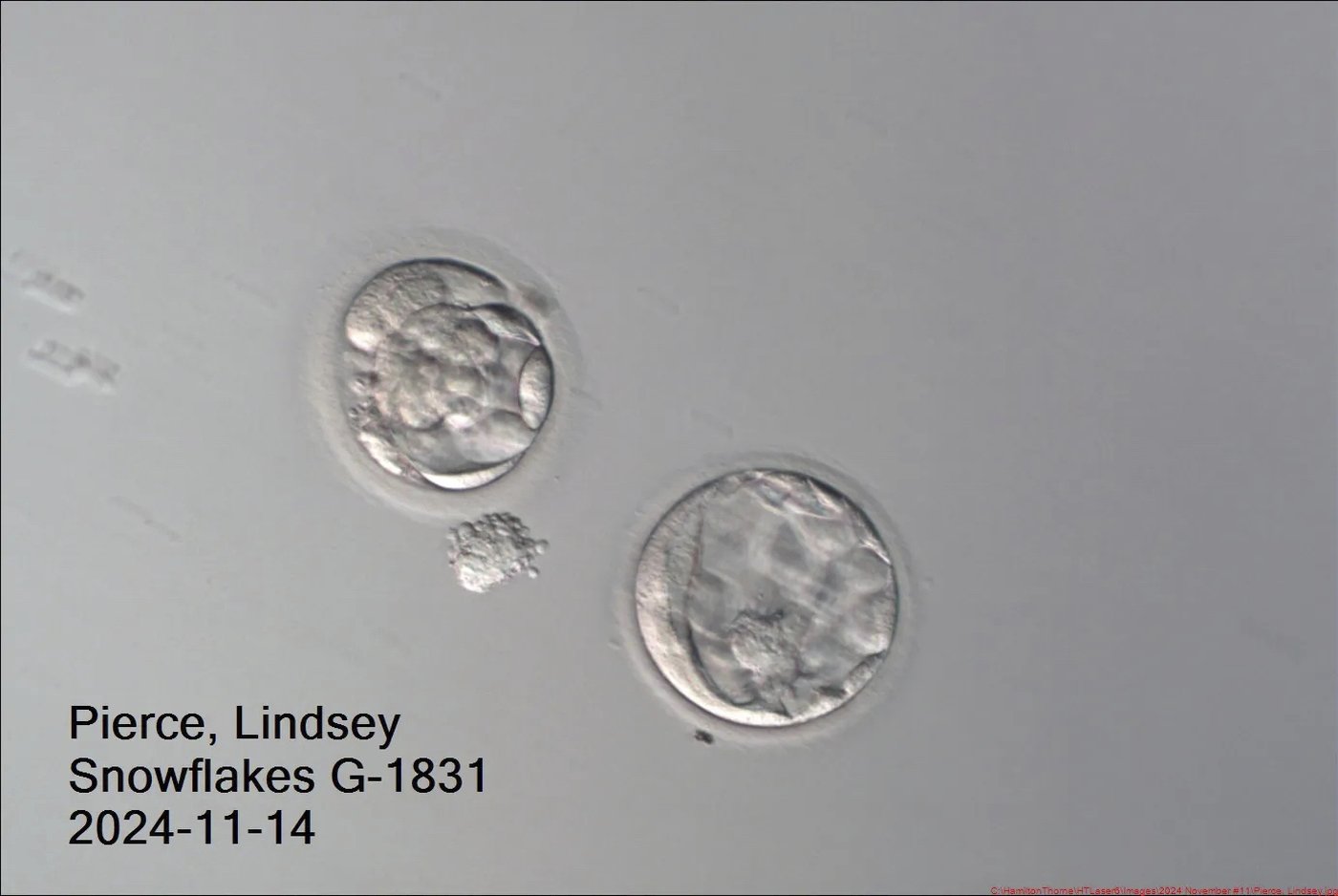 An Ohio couple welcomes a baby boy from a nearly 31-year-old frozen embryo | iNFOnews.ca
