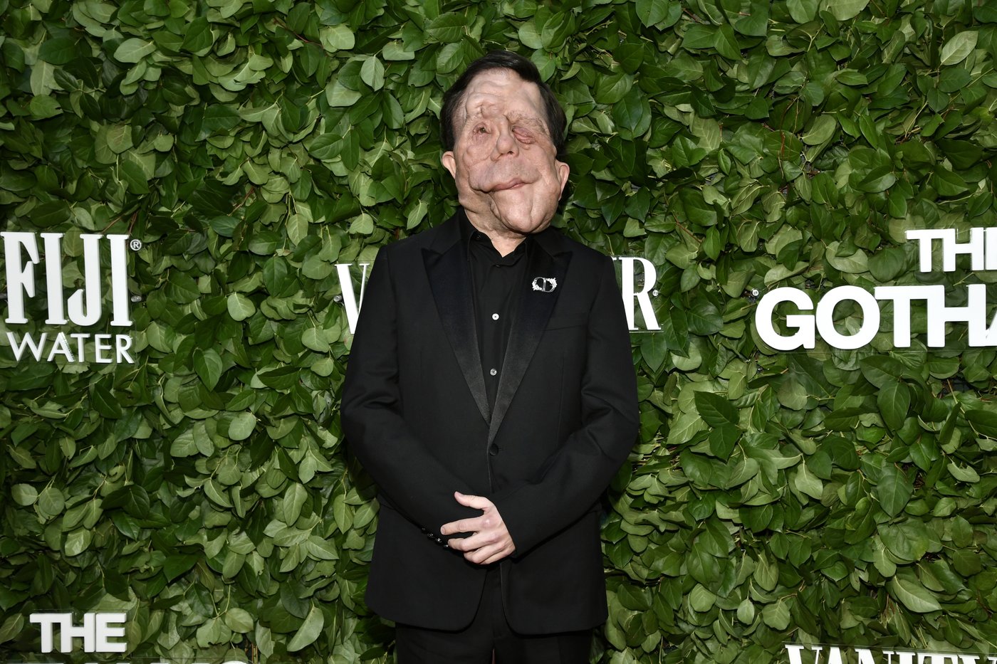 Dark comedy 'A Different Man' surprisingly triumphs at Gotham Awards | iNFOnews.ca