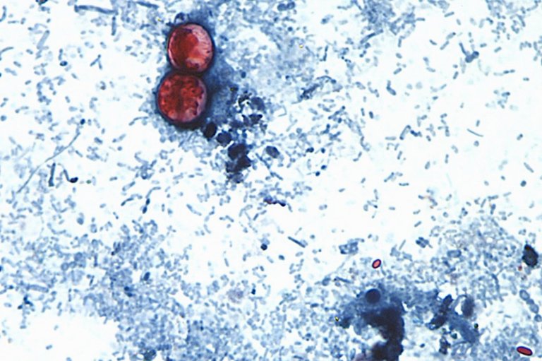 US health officials are investigating a new outbreak of a diarrhea-causing parasite | iNFOnews.ca