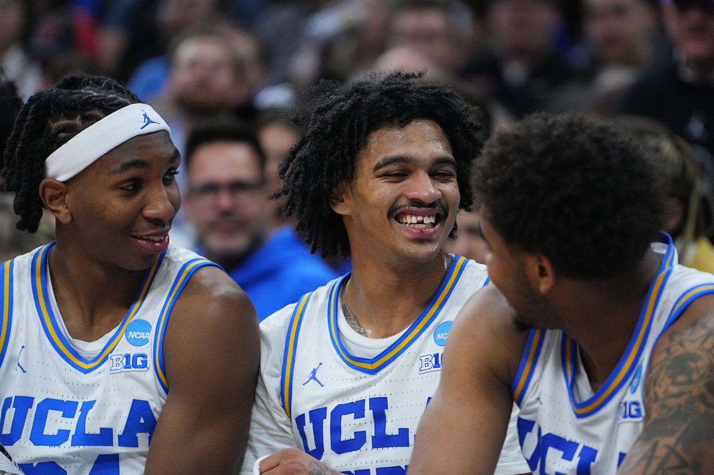 UCLA overcomes broken tooth and stubborn UCF 75-71 to advance in the NCAA Tournament | iNFOnews.ca UCLA overcomes broken tooth and stubborn UCF 75-71 to advance in the NCAA Tournament | iNFOnews.ca