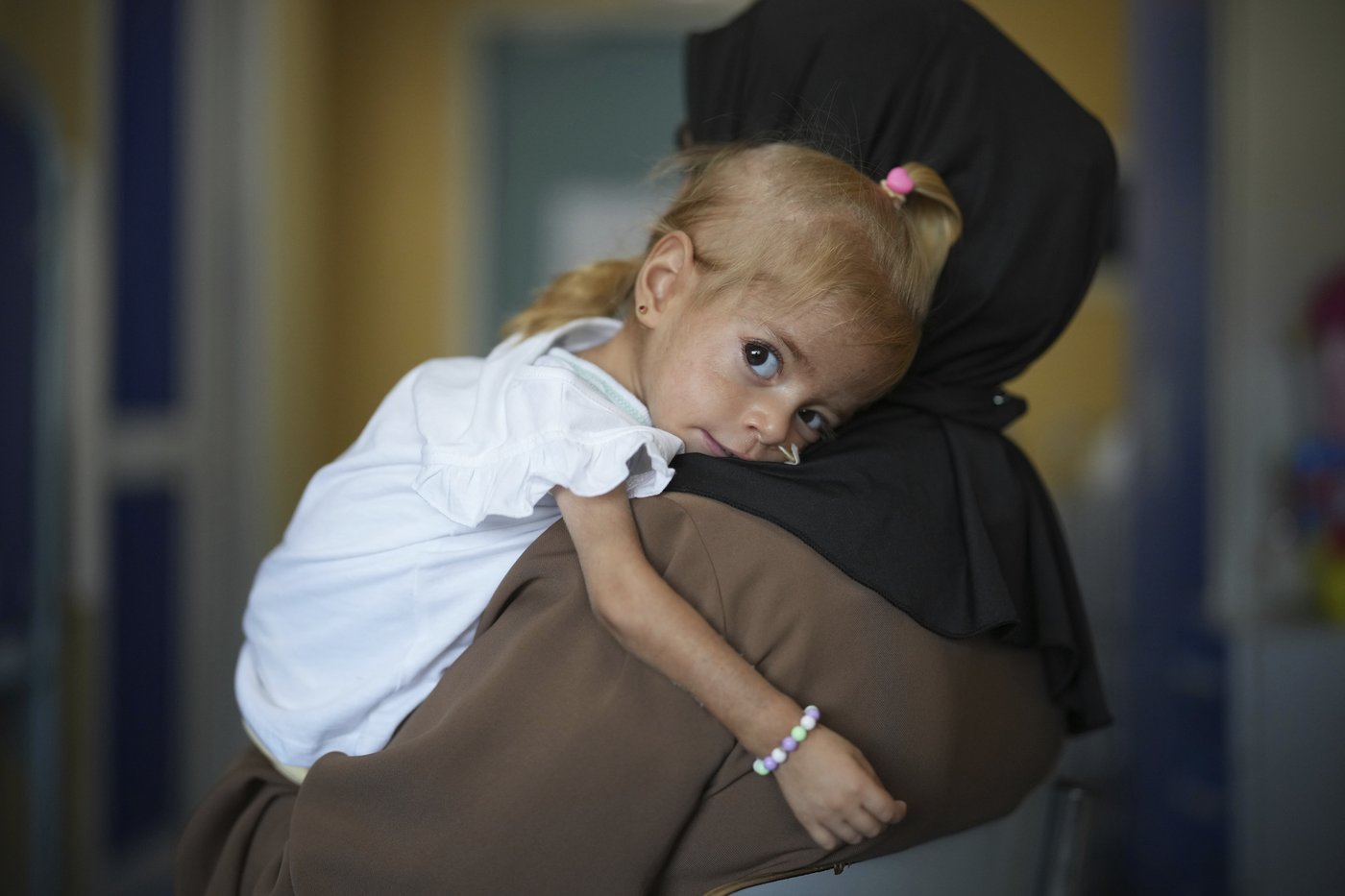 Toddler evacuated from Gaza with rare disease recovers from malnutrition in Italian hospital | iNFOnews.ca Toddler evacuated from Gaza with rare disease recovers from malnutrition in Italian hospital | iNFOnews.ca