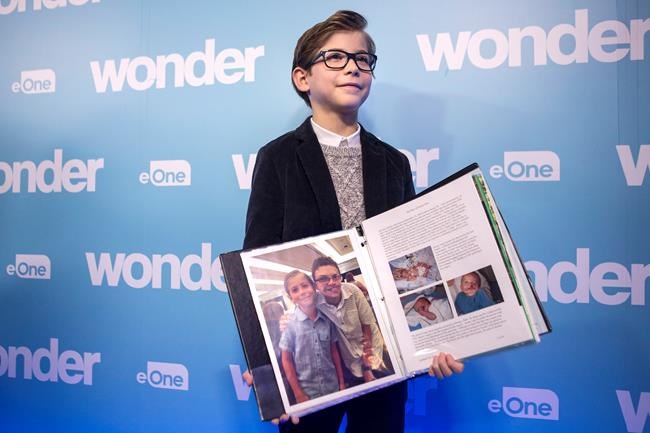 'Wonder' star Tremblay, kids with facial differences meet for screening of film | iNFOnews.ca CP155435553