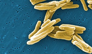 Sanofi recalls TB vaccine over quality issues; Canada scrambles for new supply | iNFOnews.ca CP18834002