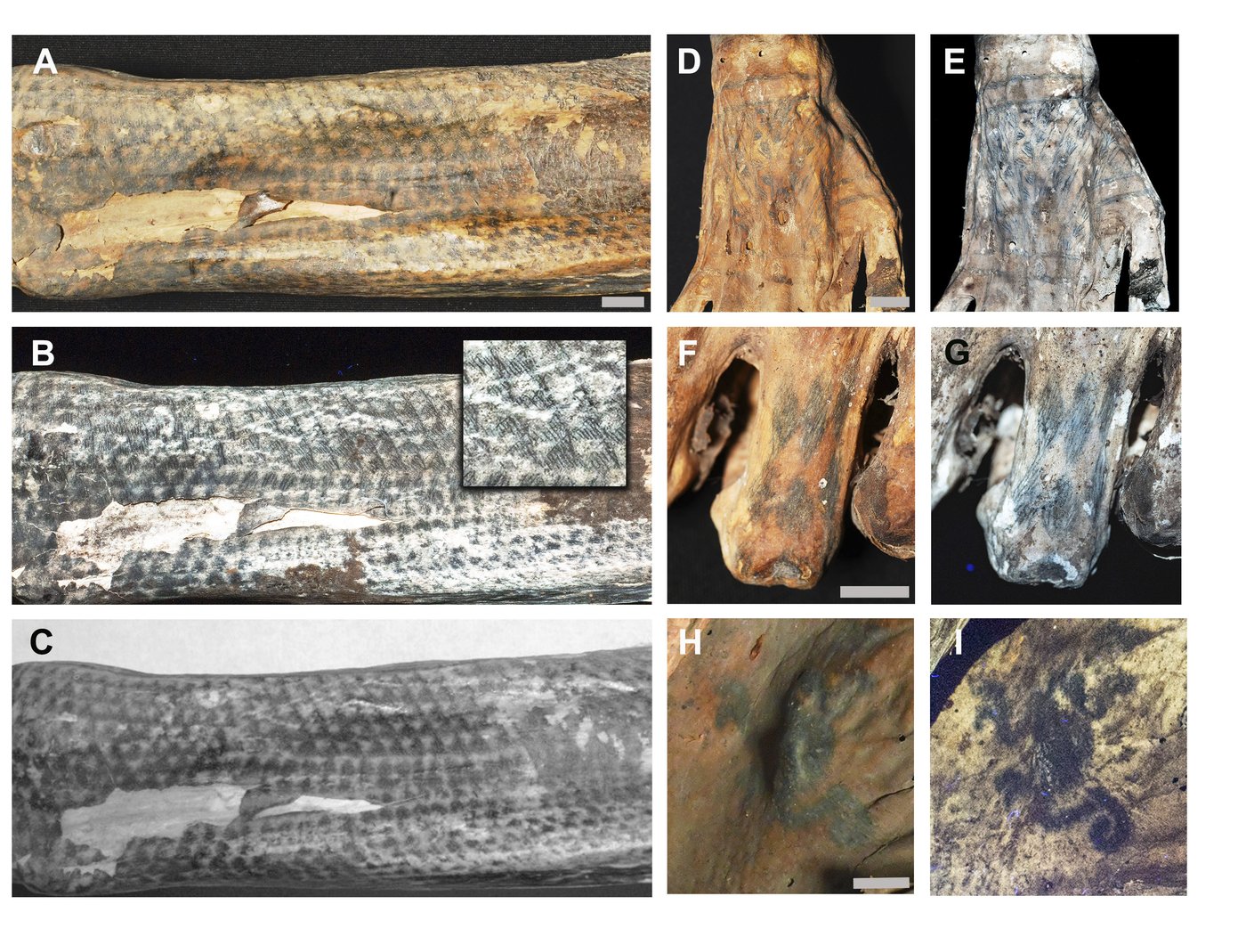 Lasers help archaeologists study ancient tattoos on Peruvian mummies | iNFOnews.ca